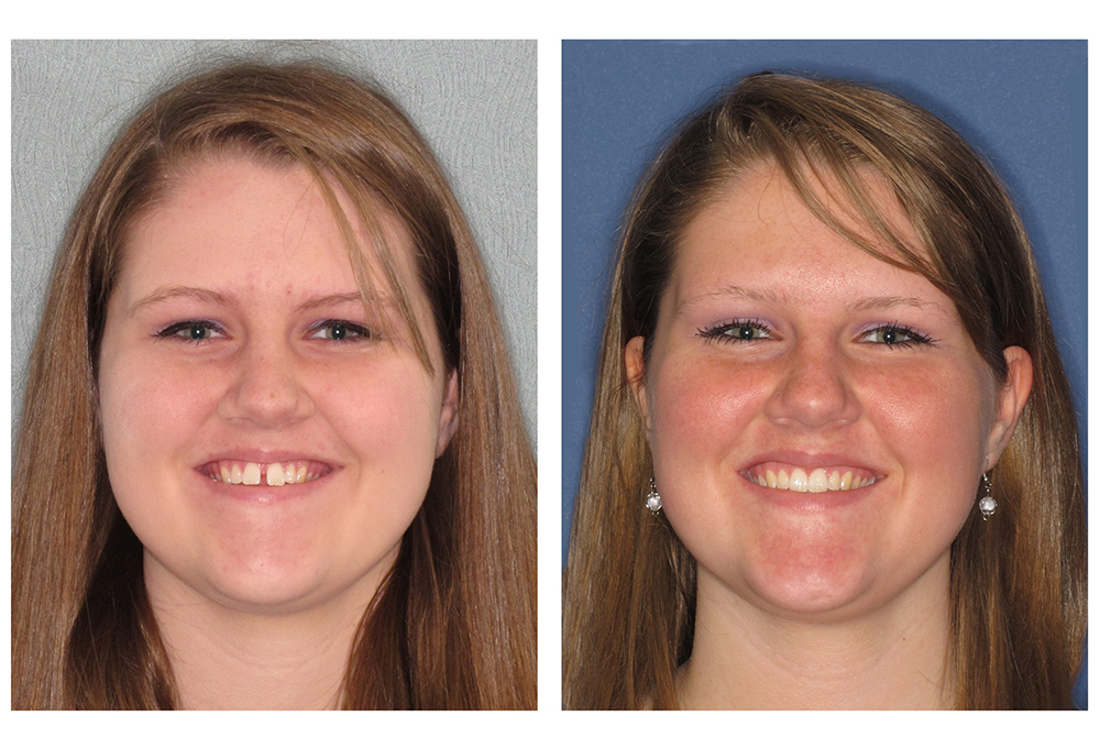 Norwalk Dental Care | Detecci  n de C  ncer Oral, Radiograf  as Digitales and Empastes Dentales del Color del Diente