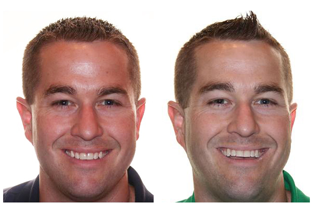 Norwalk Dental Care | Cuidado Preventivo y Limpieza, Blanqueamiento Profundo KOR and Detecci n de C ncer Oral