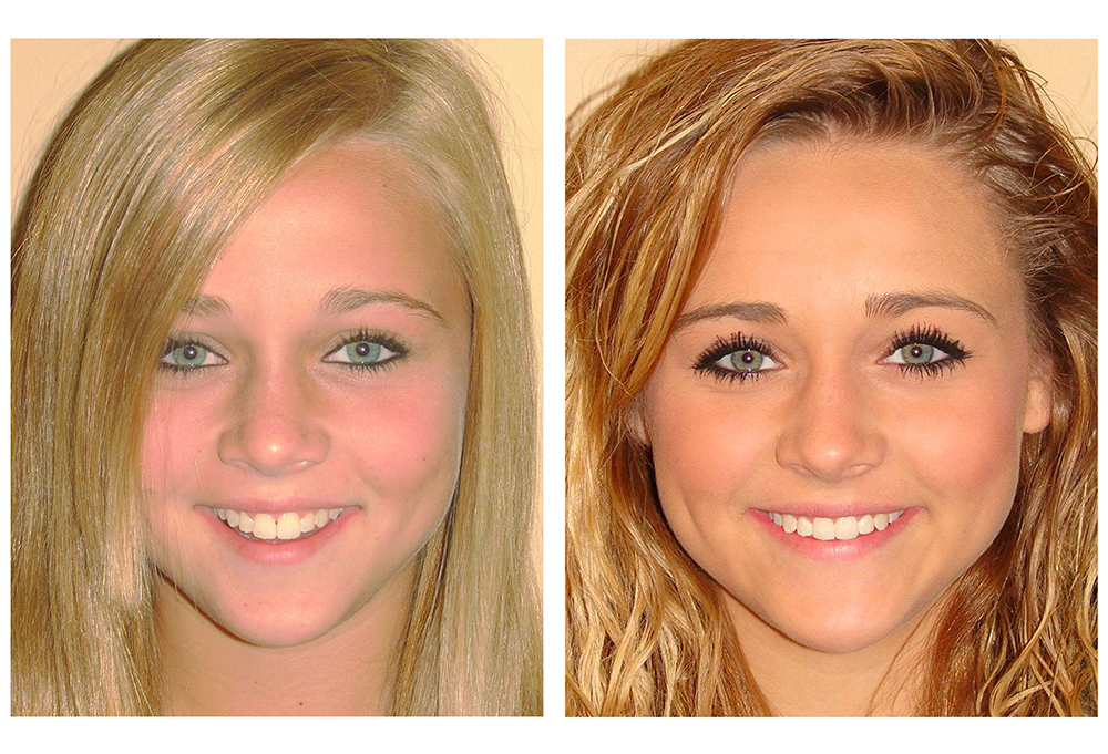 Norwalk Dental Care | Implantes Dentales, Selladores Dentales and Detecci n de C ncer Oral